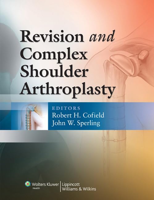 Revision and Complex Shoulder Arthroplasty Kit - Advanced Surgical Implant System for Shoulder Replacement & Reconstruction - Ideal for Orthopedic Surgeons & Medical Professionals