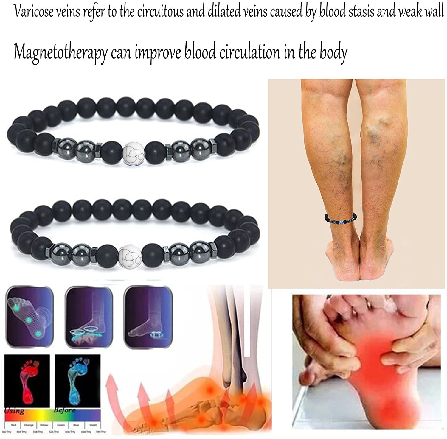 4PCS Black Obsidian Anklet & Bracelet Set - Anti-Swelling, Lymphatic Drainage, Anti-Anxiety Healing Stone Jewelry for Women & Men - Perfect for Yoga, Meditation & Stress Relief