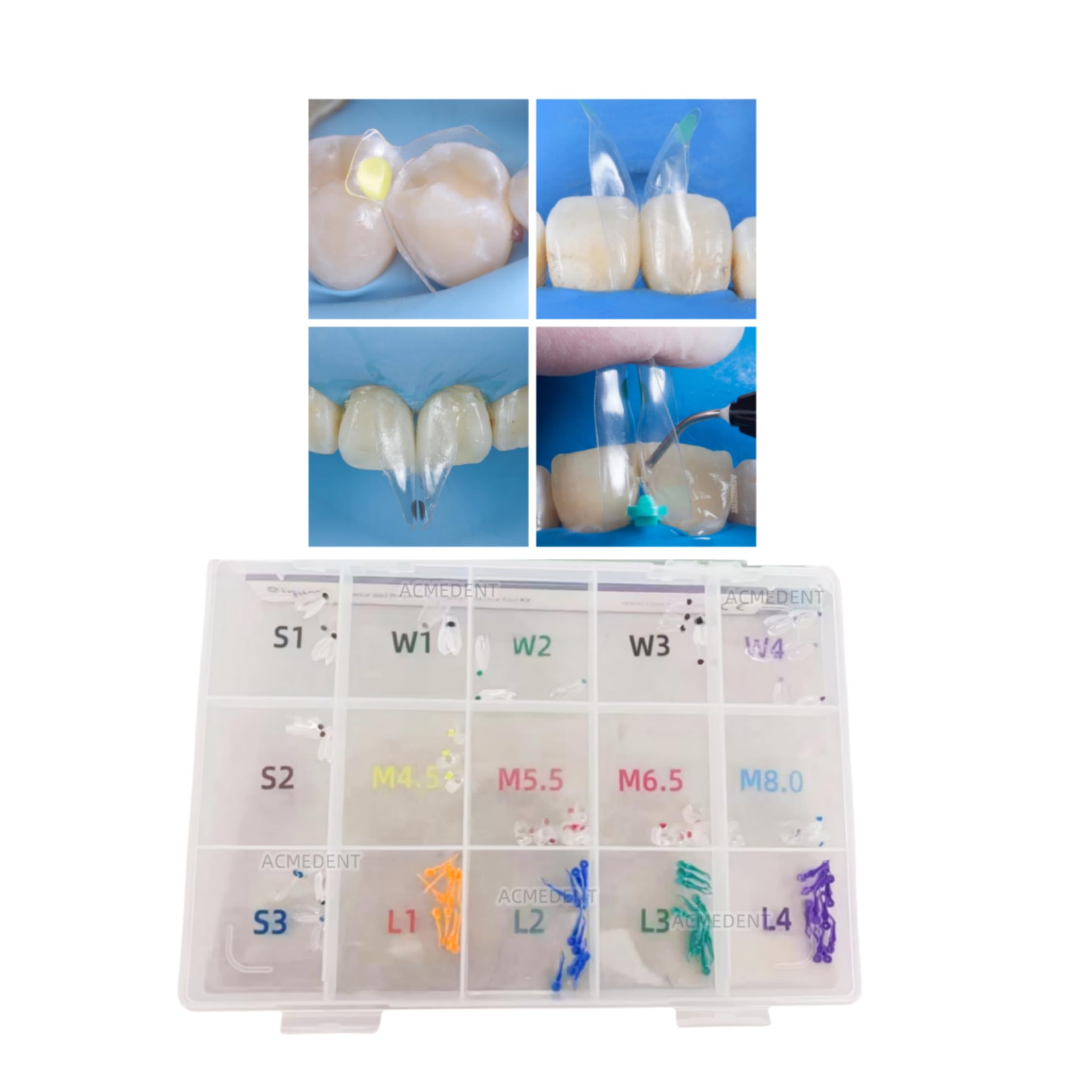 Clear Matrix Dental BT Matrices - Black Triangle Wedges for Diastema & Gaps, Transparent Sectional Matrix System for Dental Restorations | Perfect for Composite Fillings, Veneers & Cosmetic Dentistry