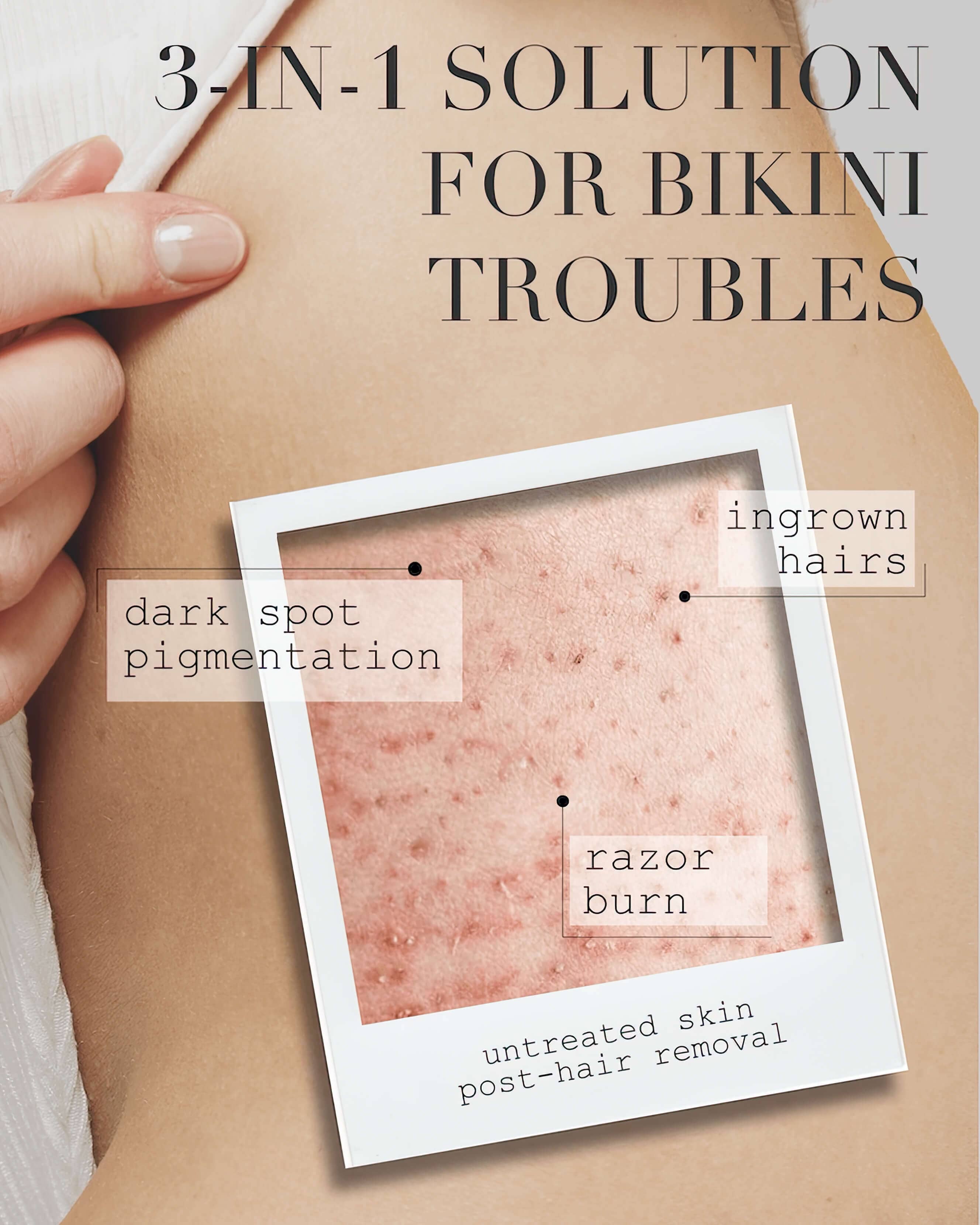 Brightening Milk for Bikini Area - Skin Lightening & Even Tone Treatment | Perfect for Summer Swimwear & Intimate Care
