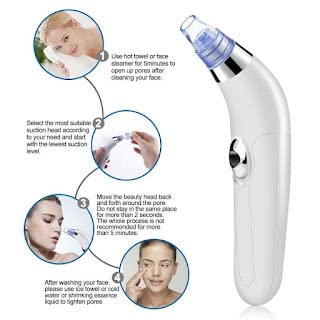 NL TRADERS Professional Acne Pore Cleaner Vacuum - Blackhead & Whitehead Remover Kit for Clear Skin | Derma Suction Tool for Pimple & Acne Treatment | Skin Care Device for Face Cleansing & Blemish Removal (White) | Perfect for Home Spa & Daily Skincare Routine