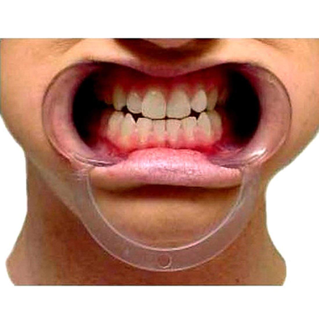 15-Piece Speak Out Dental Cheek Retractor Set - Watch Ya Mouth Game Accessories for Adults & Kids - Teeth Whitening & Dental Exam Mouth Opener - S/M/L Sizes in Blue & Clear (Large) - Perfect for Family Game Nights & Dental Hygiene Routines