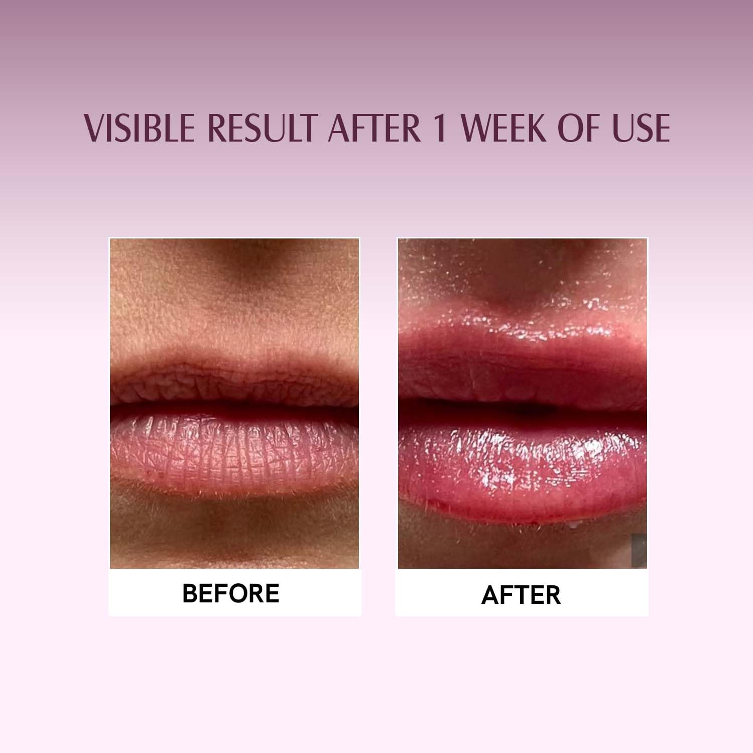 Organic Beetroot Lip Balm with Shea Butter & Cocoa Butter - Moisturizing Treatment for Dry, Chapped Lips - Natural Lip Care with Beetroot Extract - 8g Red - Perfect for Winter Skincare & Daily Hydration