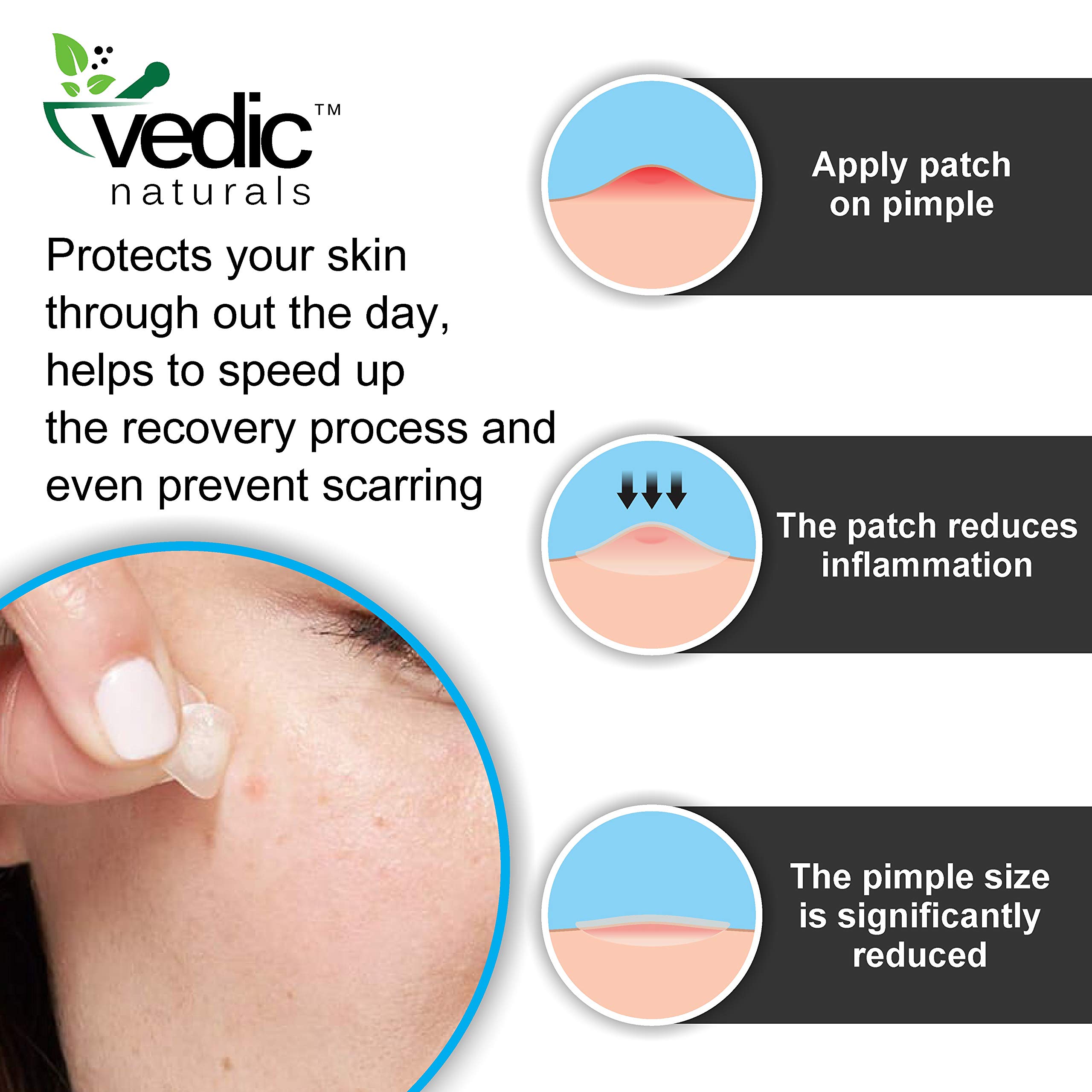 Vedic Naturals Hydrocolloid Acne Pimple Patches - 36 Count Transparent Face Stickers for Fast Pimple Healing | Skin Treatment Cover for Teens & Adults | Drug-Free, Non-Drying & Waterproof | Perfect for Overnight Spot Treatment & Daily Blemish Care