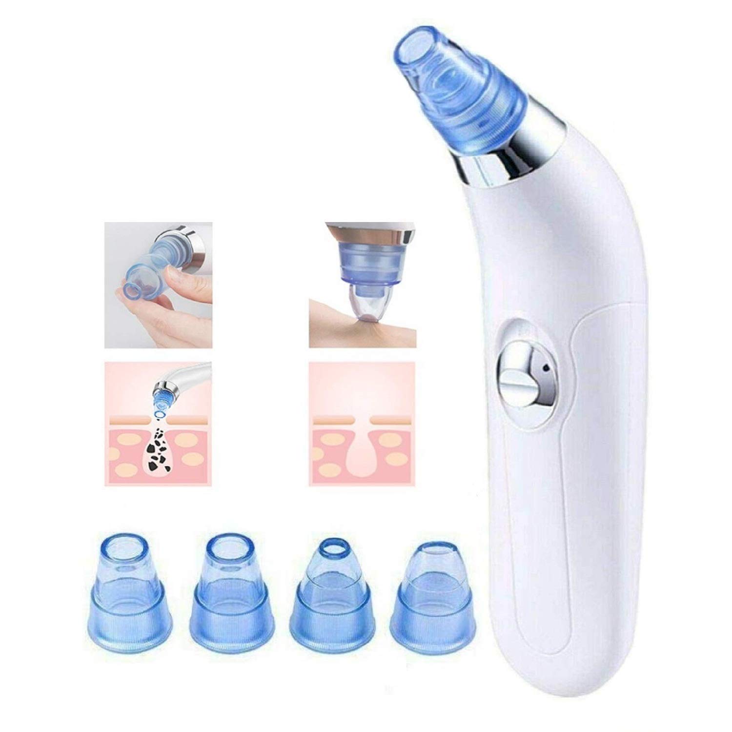 McMus Professional Acne Pore Cleaner & Blackhead Remover Kit - Facial Cleansing Vacuum Tool for Pimple & Acne Treatment - Skin Care Device for Men & Women - Perfect for Daily Deep Cleansing & Spa Skincare Routine