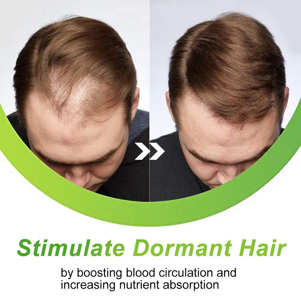 7X Fast Hair Growth Serum - Ginger & Germinal Oil Treatment for Thicker Hair & Anti Hair Loss - Promotes Regrowth for Men & Women (2Pcs) - Perfect for Daily Use, Hair Repair & Scalp Care