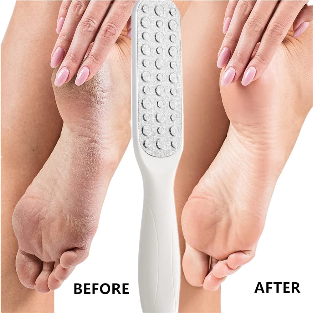 Professional Pedicure Kit - Dead Skin Remover, Foot File & Nail Cutter for Cracked Heels - Deluxe Foot Scraper & Callus Shaver - Perfect for Home Spa, Pedicure Treatment & Softening Rough Feet