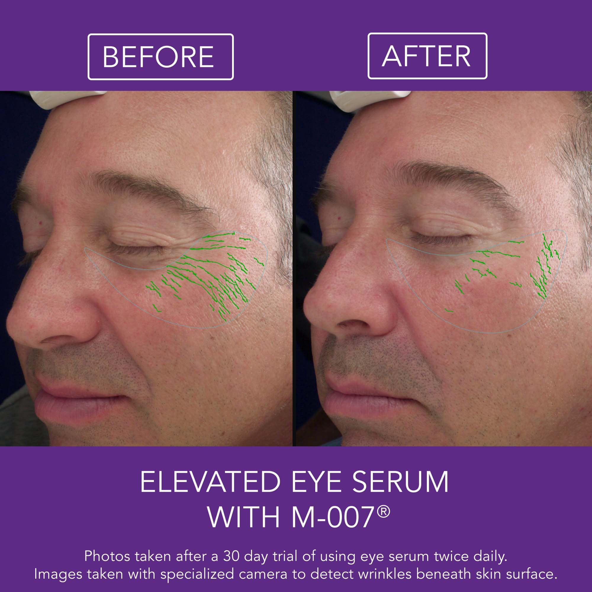 Omni Bioceuticals M-007® Anti-Aging Eye Serum - 15ml + 15ml Refill | Dark Circle & Wrinkle Treatment | Day & Night Eye Care for Brighter, Youthful Eyes