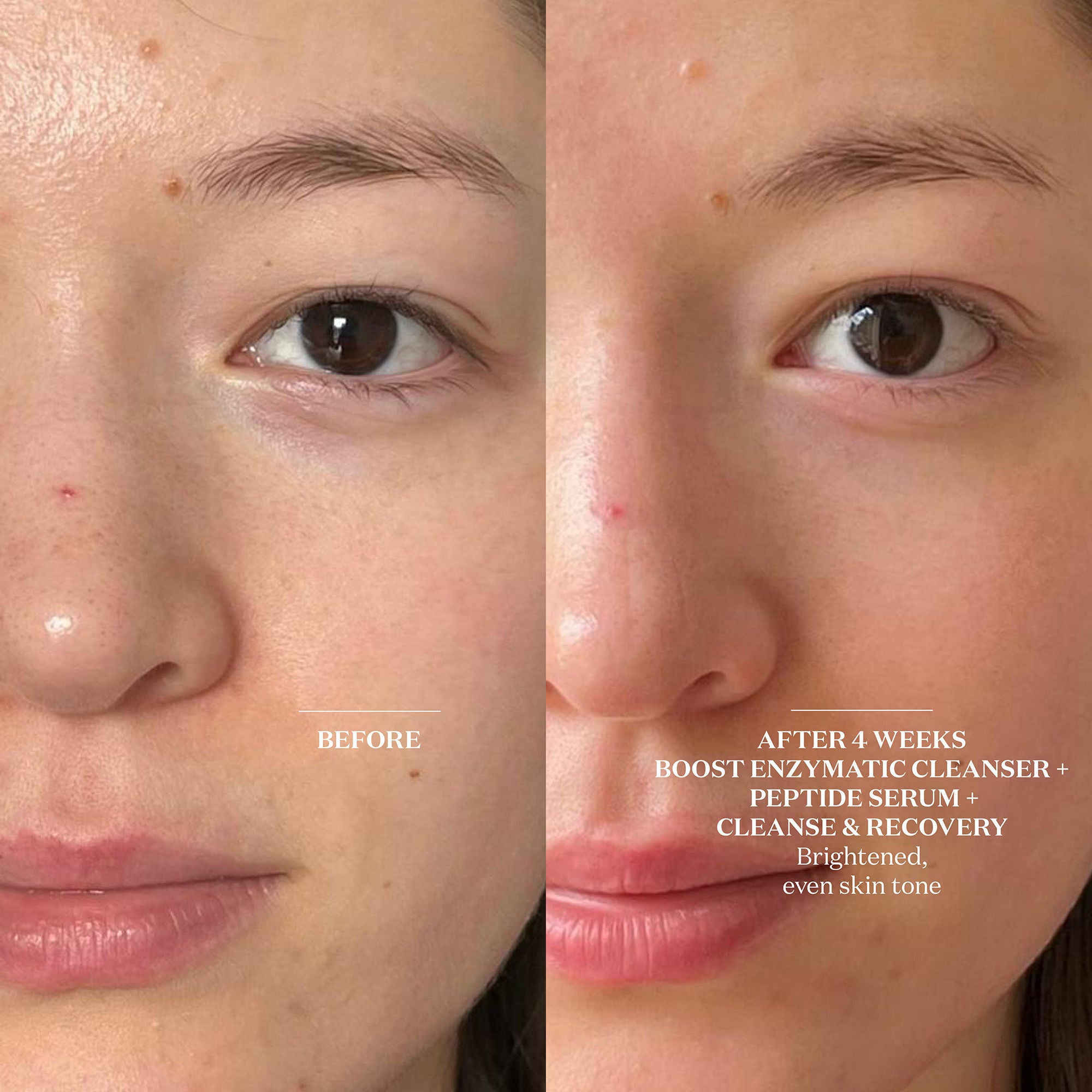 Best Hydrating Peptide Serum for Face - Anti-Aging & Moisturizing Facial Treatment - Perfect for Dry Skin & Nighttime Skincare Routine