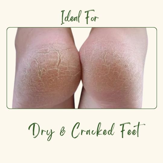 BodyHerbals Natural Foot Cream for Dry, Cracked Heels - Moisturizing Treatment with Shea Butter, Beeswax & Lemon | Callus & Cracked Skin Repair | Paraben & Sulfate Free | Men & Women | All Skin Types | Perfect for Nightly Foot Care & Pedicure Prep