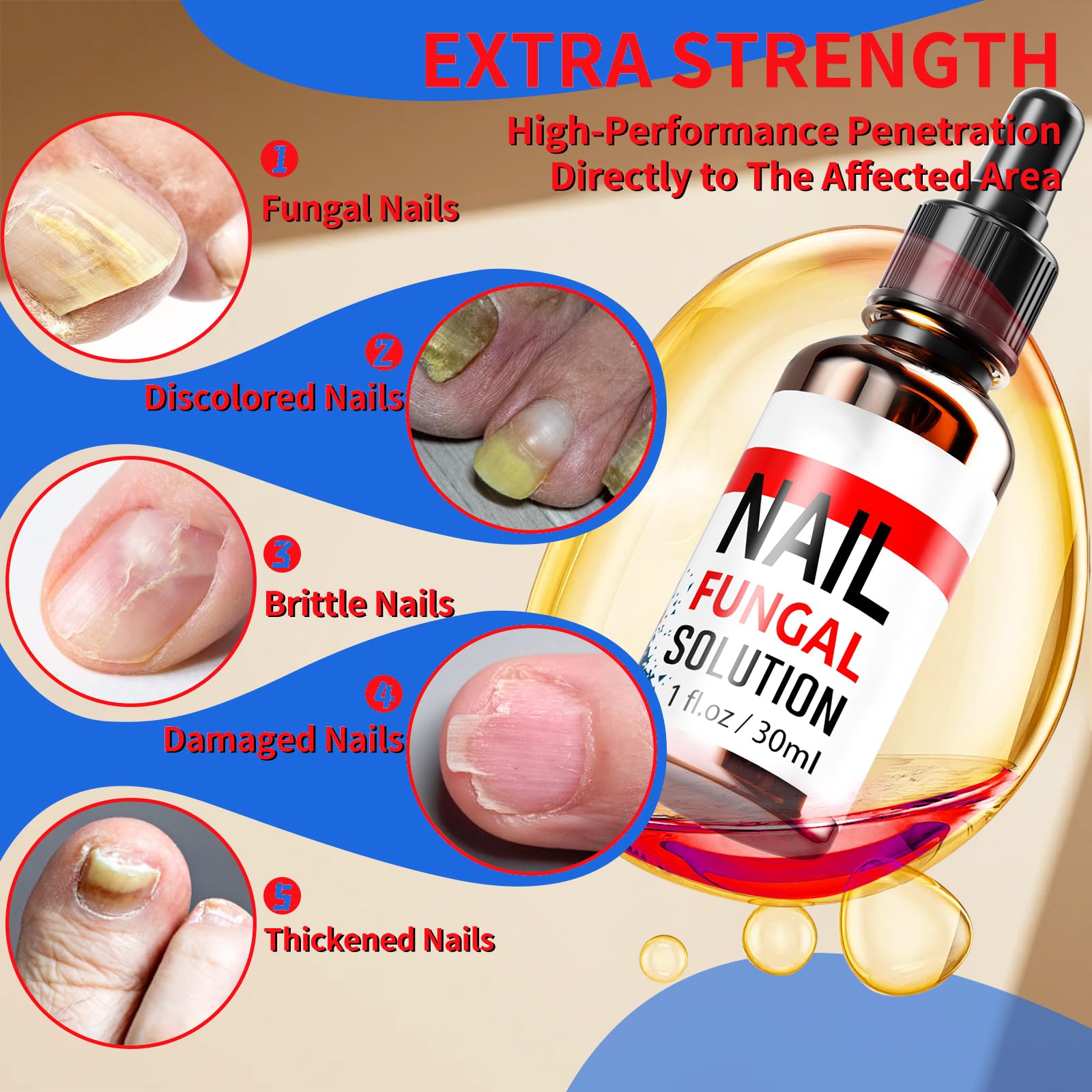 Extra Strength Toenail Fungus Treatment for Fingernails & Toenails - 30ML Safe & Gentle Nail Repair Solution with Fungus Softener | Effective Nail Care for Athletes, Swimmers & Pedicure Lovers