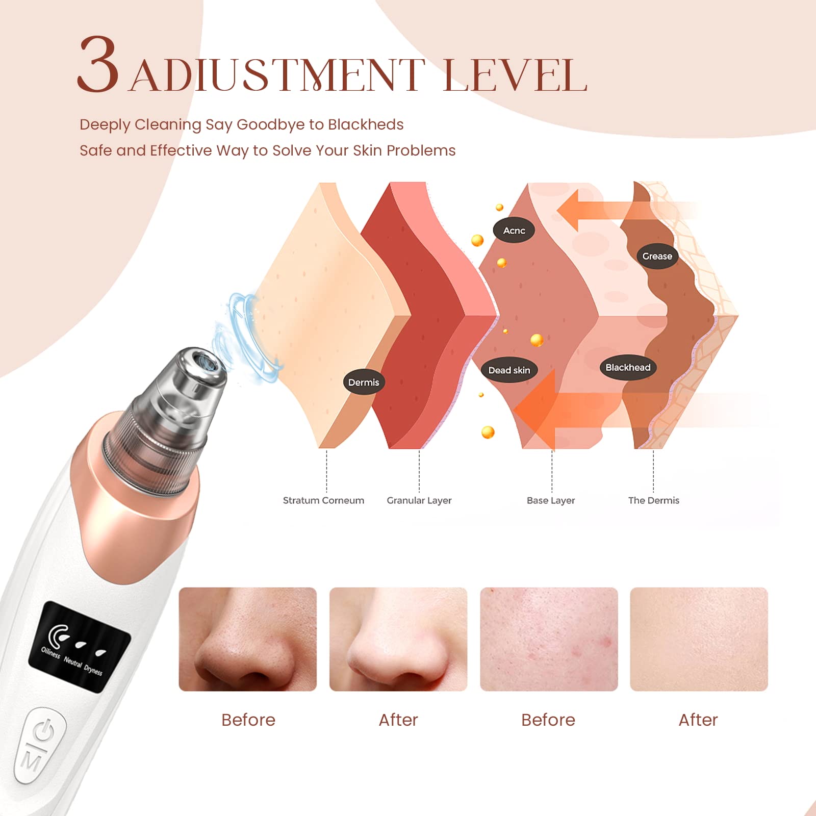 Electric Blackhead Remover Vacuum - 5 Suction Power & Probes for Deep Pore Cleaning | Facial Care at Home