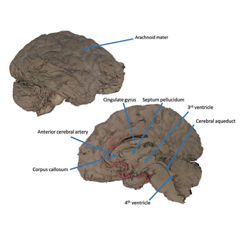 3D Printed Brain Hemisection Model - Anatomical Human Brain Study Tool for Neuroscience Education & Medical Training