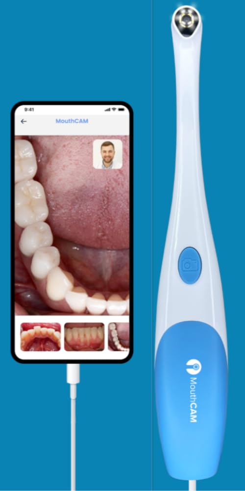 Dental Intraoral Camera for Dentists - High Resolution Oral Exam Camera for Teeth Inspection, Diagnosis & Treatment - Perfect for Dental Clinics, Orthodontics & Home Use
