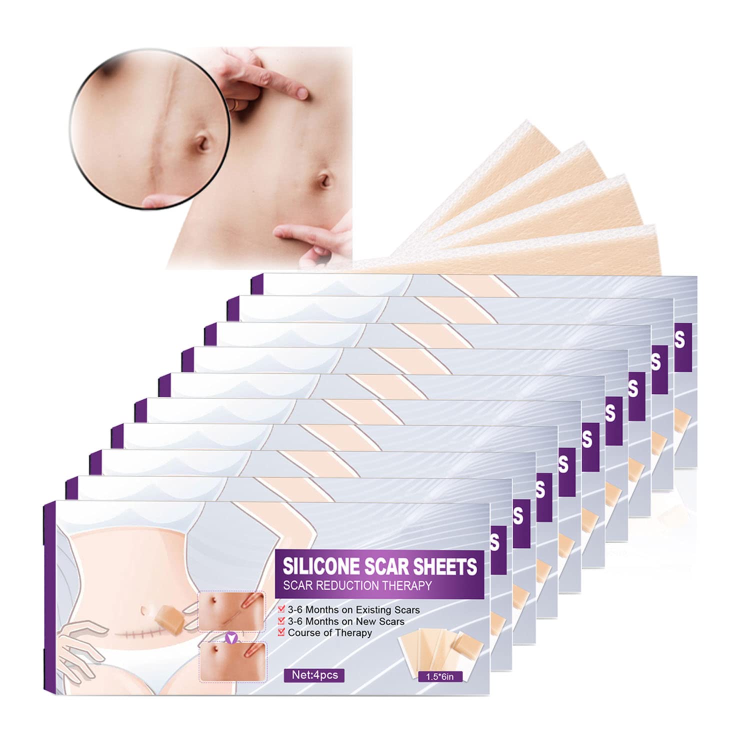 QINGTING Silicone Scar Sheets for Scar Removal - 10 Pack | Medical Grade Silicone Gel Sheets for Surgery Scars, Burns, Acne, Keloids & Stretch Marks | Painless Treatment for Old & New Scars | Perfect for Post-Surgery Recovery & Skin Care