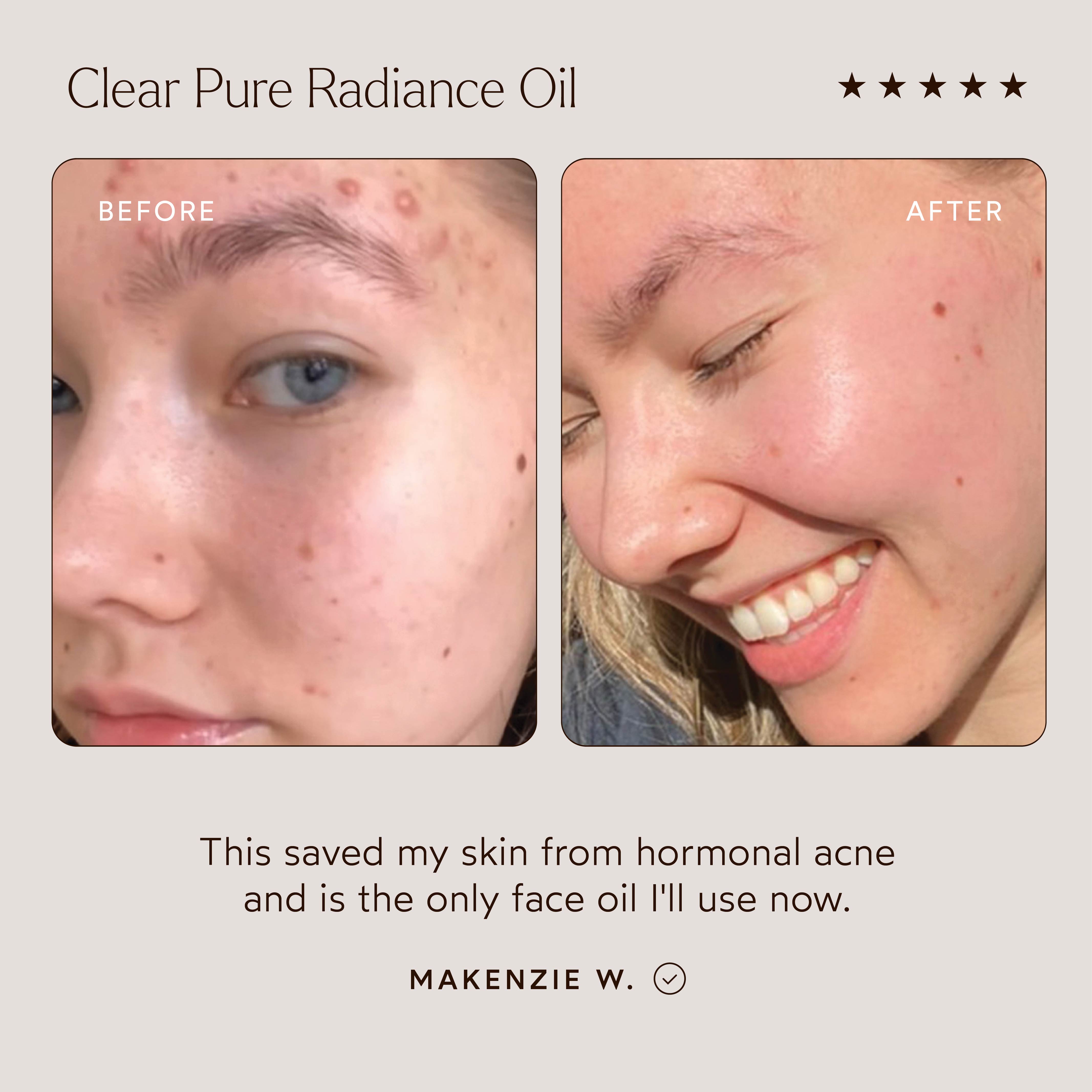 Pure Radiance Facial Oil for Glowing Skin - Hydrating & Brightening Face Oil for Dry & Dull Skin | Day & Night Skincare Routine