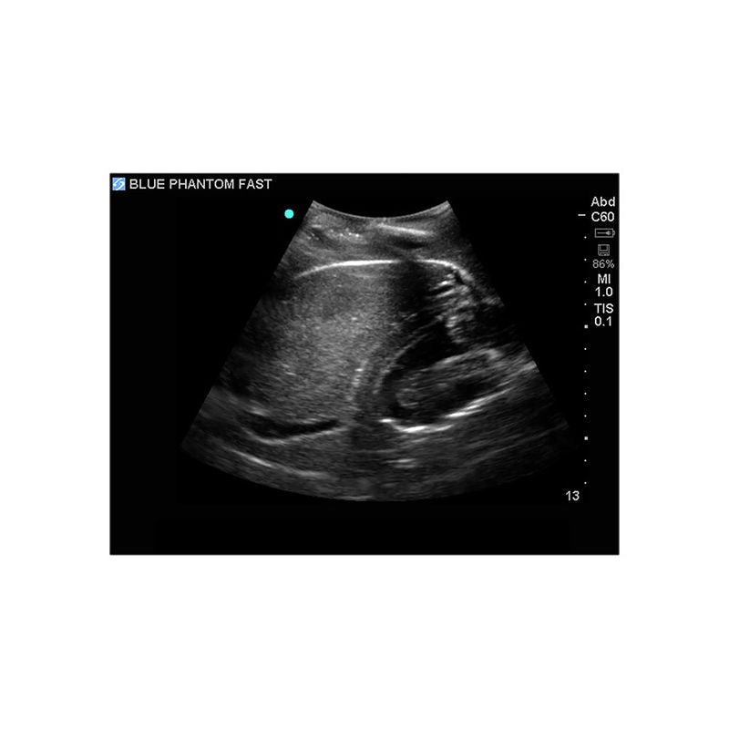 FAST Exam Ultrasound Training Model - Transthoracic & Transesophageal Echo Simulator for Cardiac Sonography Practice (Ideal for Medical Students, Ultrasound Tech Training & Clinical Skills Development)