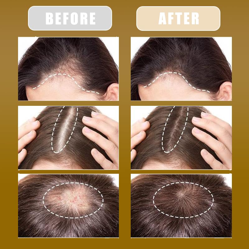 Organic Batana Oil for Hair Growth & Repair - 100% Natural Honduran Hair Oil for Damaged Hair, Smoothing & Shine (4.15 oz) - Perfect for Dry, Frizzy Hair & Scalp Care at Home