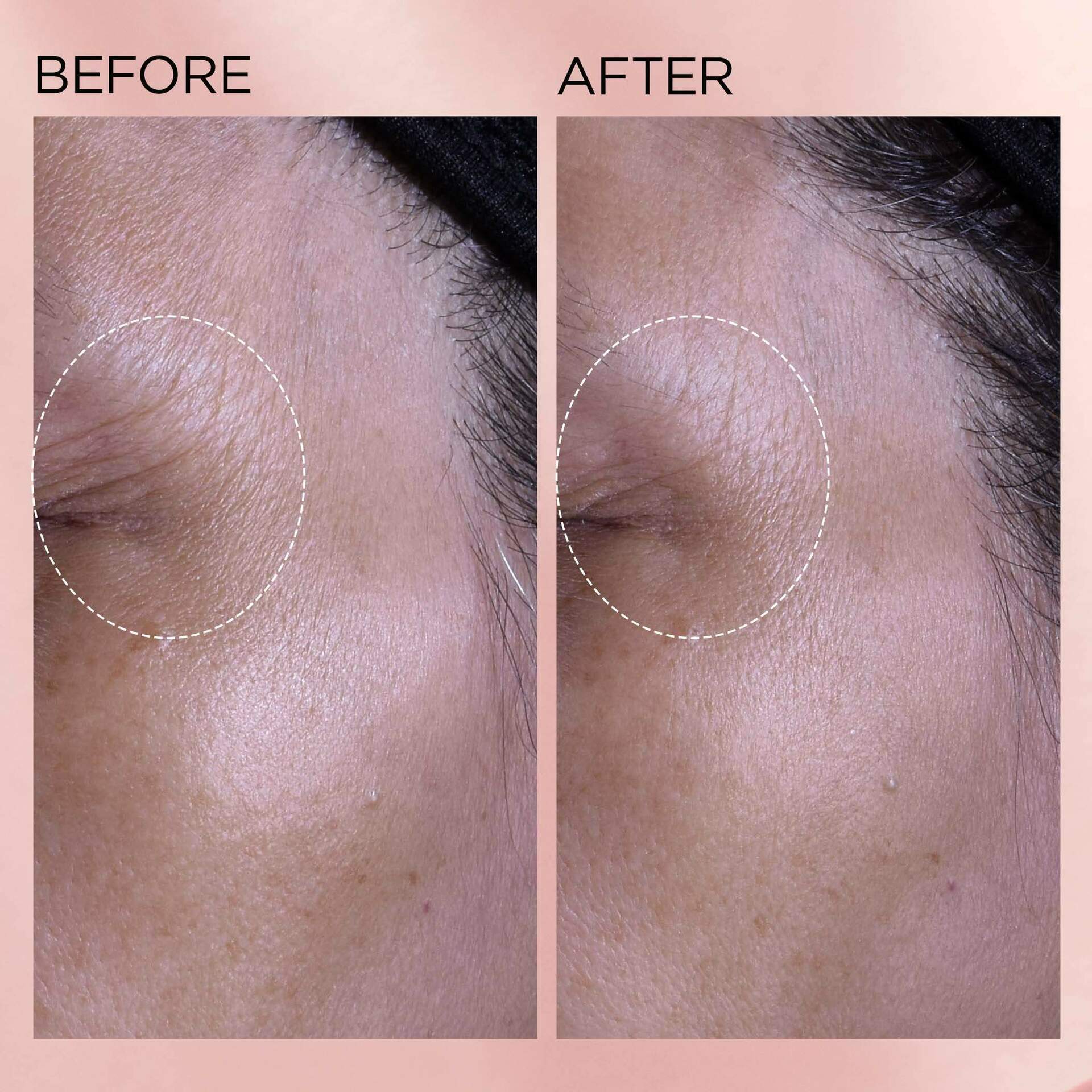 Retinol + HPR Ceramide Moisturizing Face Cream for Wrinkles & Dry Skin - Anti-Aging Night Cream for Women & Men - Hydrating Skincare for Face, Neck & Décolleté
