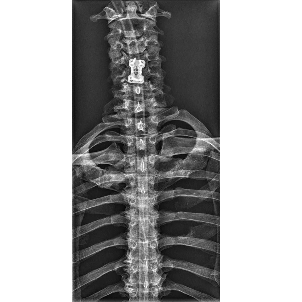 Full Body X-Ray Phantom with Real Human Skeleton Bones - High-Quality Medical Training Model for Radiology, Anatomy Studies & X-Ray Positioning Practice (Ideal for Medical Schools, Hospitals & Research Labs)