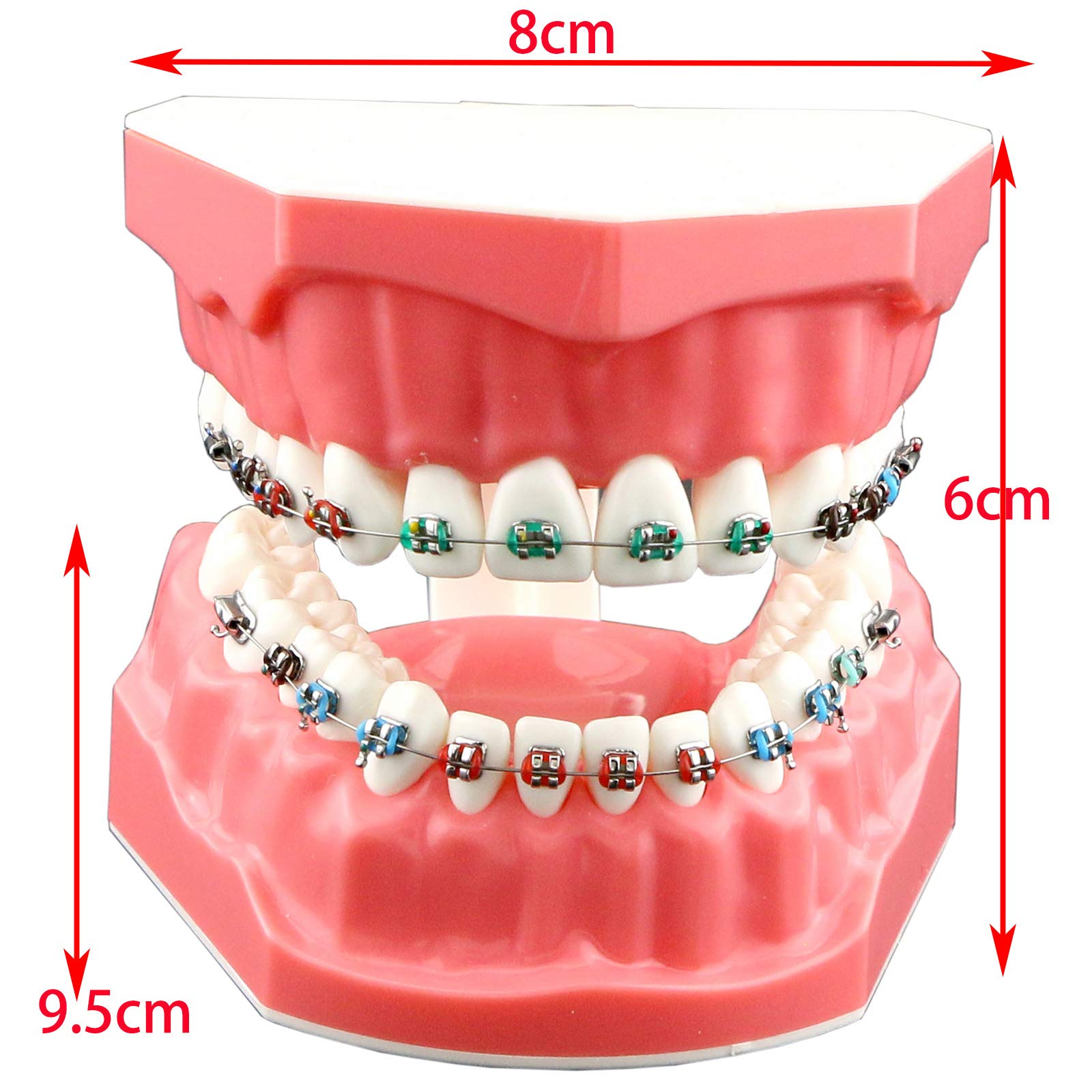 Orthodontic Dental Model with Metal Brackets, Archwires, Tubes & Ligature Ties - Standard Size Teeth Treatment Model for Dental Students & Professionals | Perfect for Teaching, Studying & Clinical Practice