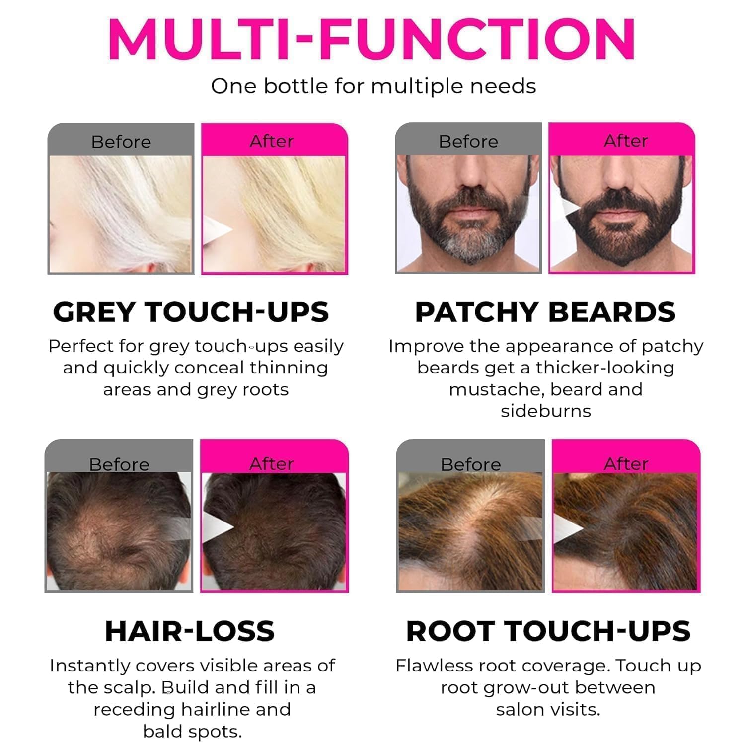 Natural Hairline Powder & Shading Sponge Pen - Quick Root Touch-Up, Eyebrow Stamp & Hairline Shadow Powder Stick (40G) - Perfect for Covering Gray Roots, Thinning Hair & Creating Fuller Hairlines at Home or On-The-Go