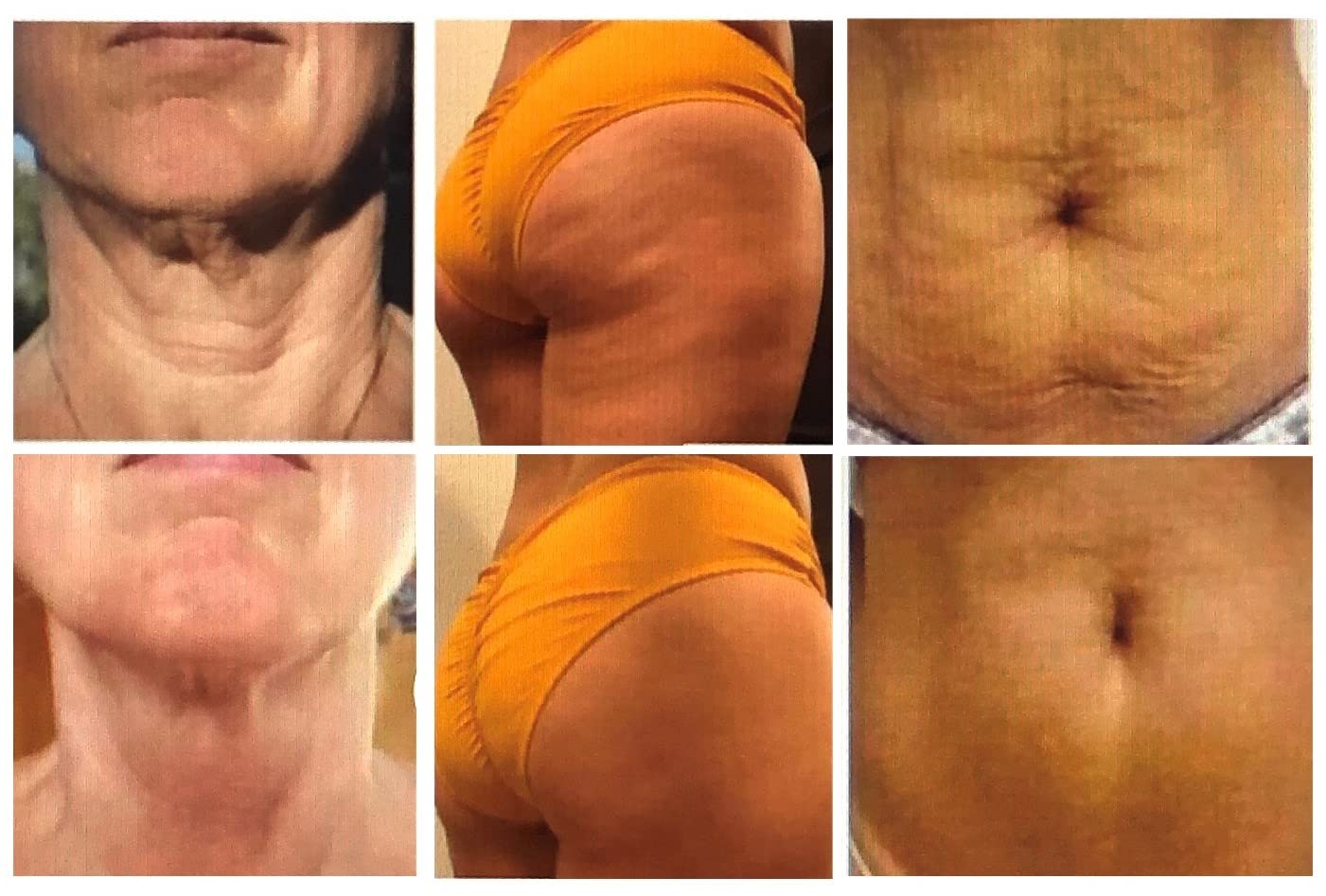 Body Firming & Cellulite Cream with Collagen (4 oz) - Visibly Reduce Cellulite, Dimpled Skin & Tighten Loose Areas | Anti-Cellulite Treatment for Thighs, Buttocks & Stomach | Daily Moisturizing Cream for Smooth Skin | Healthy Life Creations