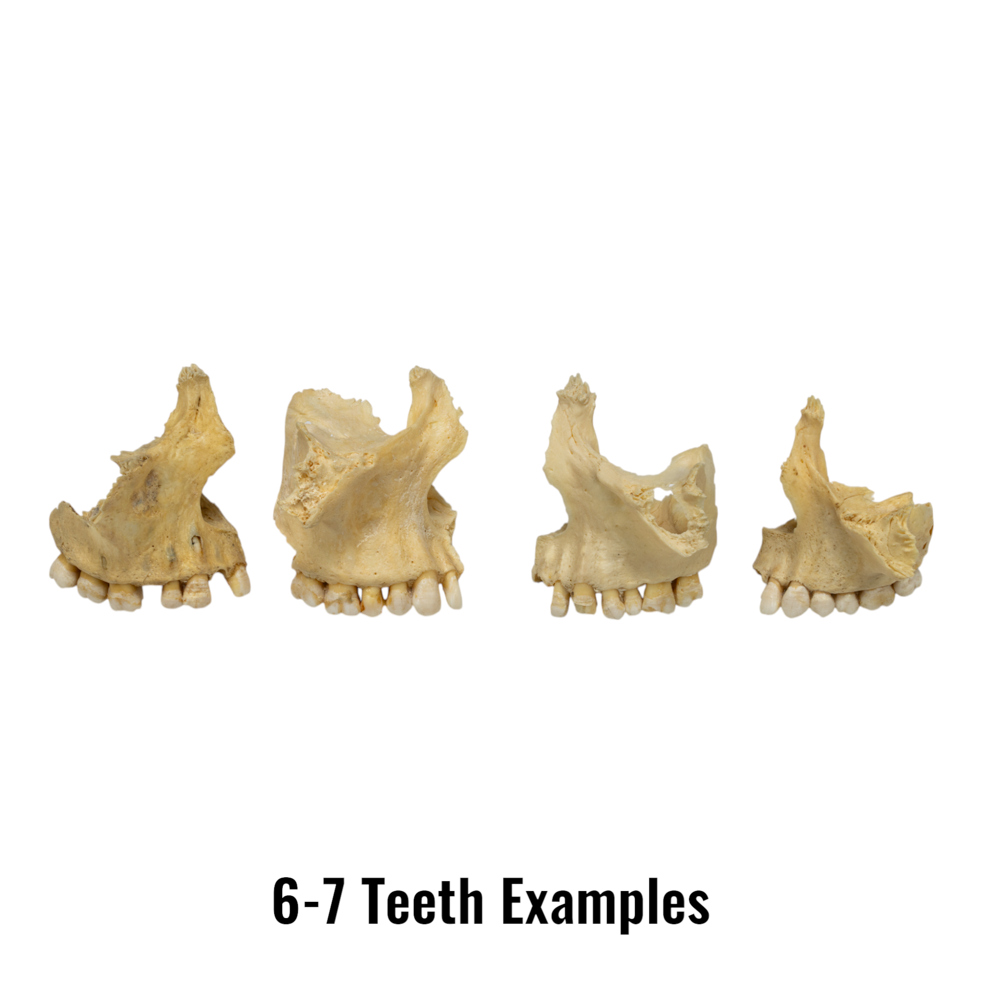 Authentic Human Maxillary Bone - Single Specimen for Medical Study, Dental Education, and Anatomy Research | Ideal for Students, Doctors, and Science Enthusiasts