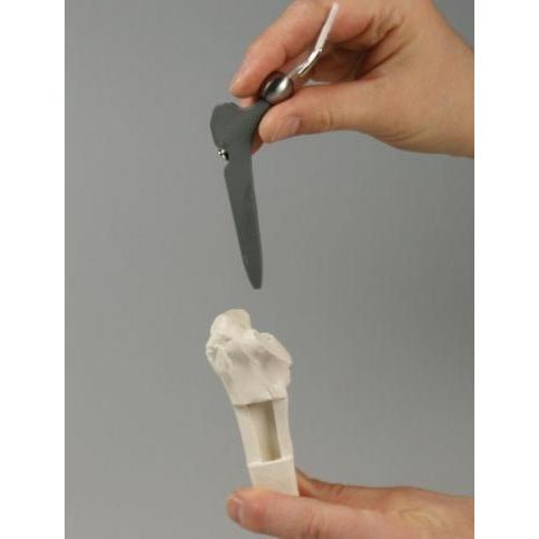 High-Quality Hip Implant Model - Medical Training & Surgical Demonstration Tool for Orthopedic Surgeons & Students