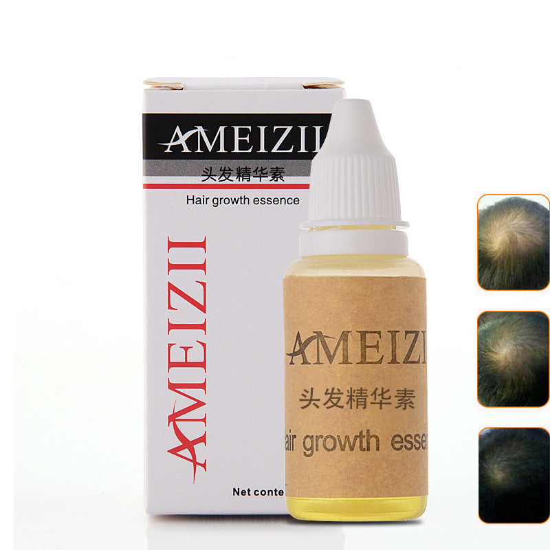 Ameizii Ginger Shampoo for Hair Growth & Scalp Care - Unisex Volumizing Shampoo with Natural Ingredients for Thicker, Healthier Hair - Perfect for Daily Use & Hair Loss Prevention