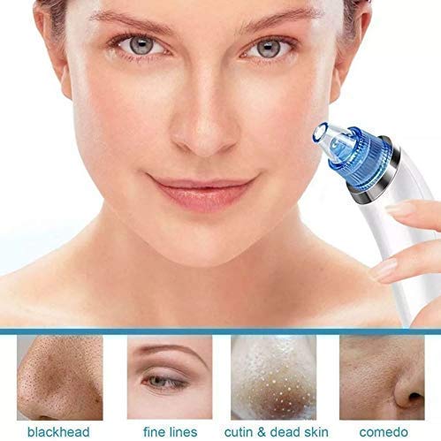 Vyoma Professional Acne Pore Cleaner & Blackhead Remover Kit - Skin Care Vacuum Tool for Pimple & Blemish Removal - Perfect for Home Spa & Facial Care (Blue)