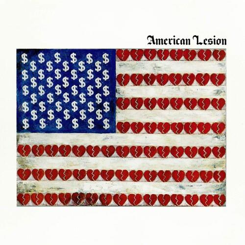 American Lesion (White Vinyl) Vinyl LP Record - Limited Edition White Colored Vinyl for Music Collectors & Audiophiles - Perfect for Home Listening, Gifts & Vinyl Collections