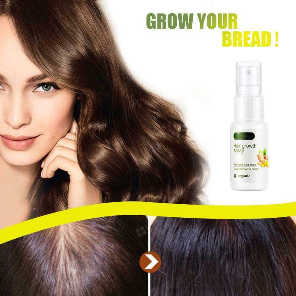 New Biotin & Ginger Hair Growth Serum - Fast Regrowth Treatment with Natural Ingredients for Thicker, Fuller Hair - Perfect for Thinning Hair, Hair Loss & Scalp Care