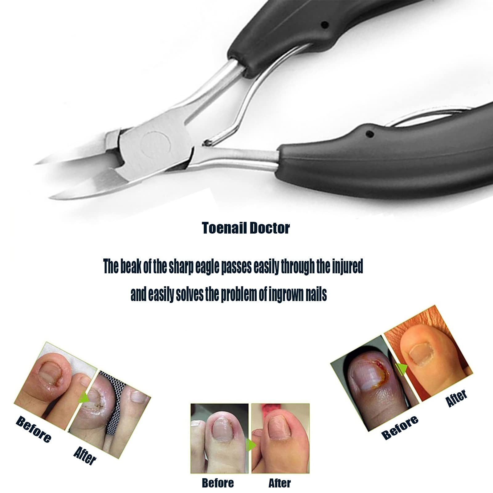 Professional Toenail Clippers for Seniors & Thick Nails - Heavy Duty Nail Clipper Set for Men & Women - Ingrown Toenail Corrector & Acrylic Nail Trimmer - Perfect for Elderly Foot Care & Pedicures at Home