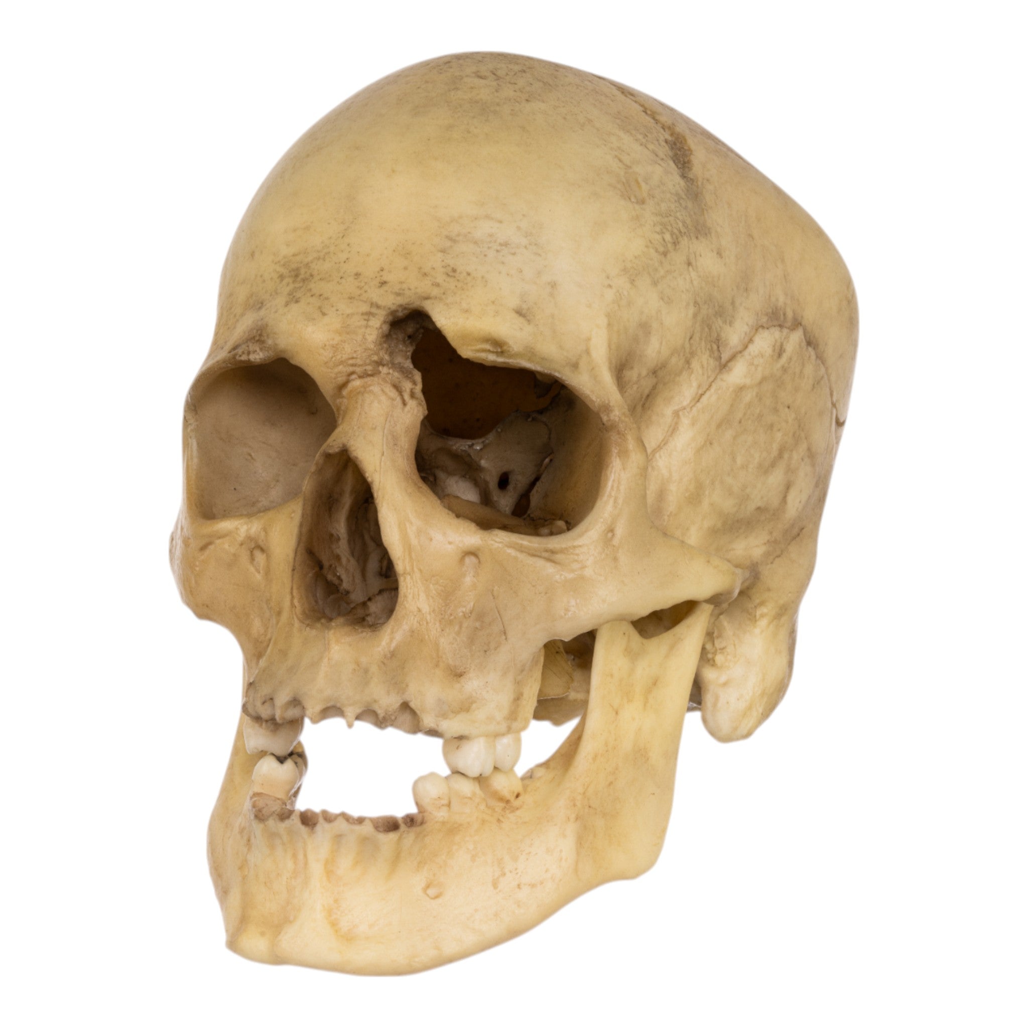 Realistic Replica Human Male Skull with 32 Caliber Gunshot Wound - Perfect for Medical Training, Forensic Studies, and Halloween Decorations