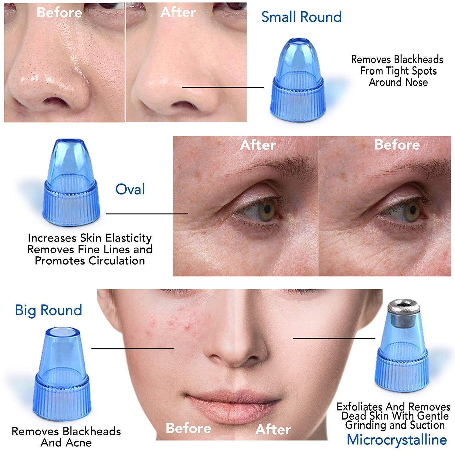 NOBILEA Derma Suction Vacuum Skin Cleanser - 4-in-1 Blackhead & Pimple Remover Tool for Deep Pore Cleansing | Acne Treatment & Facial Exfoliation Kit | Perfect for Daily Skincare, Spa & At-Home Beauty Routine