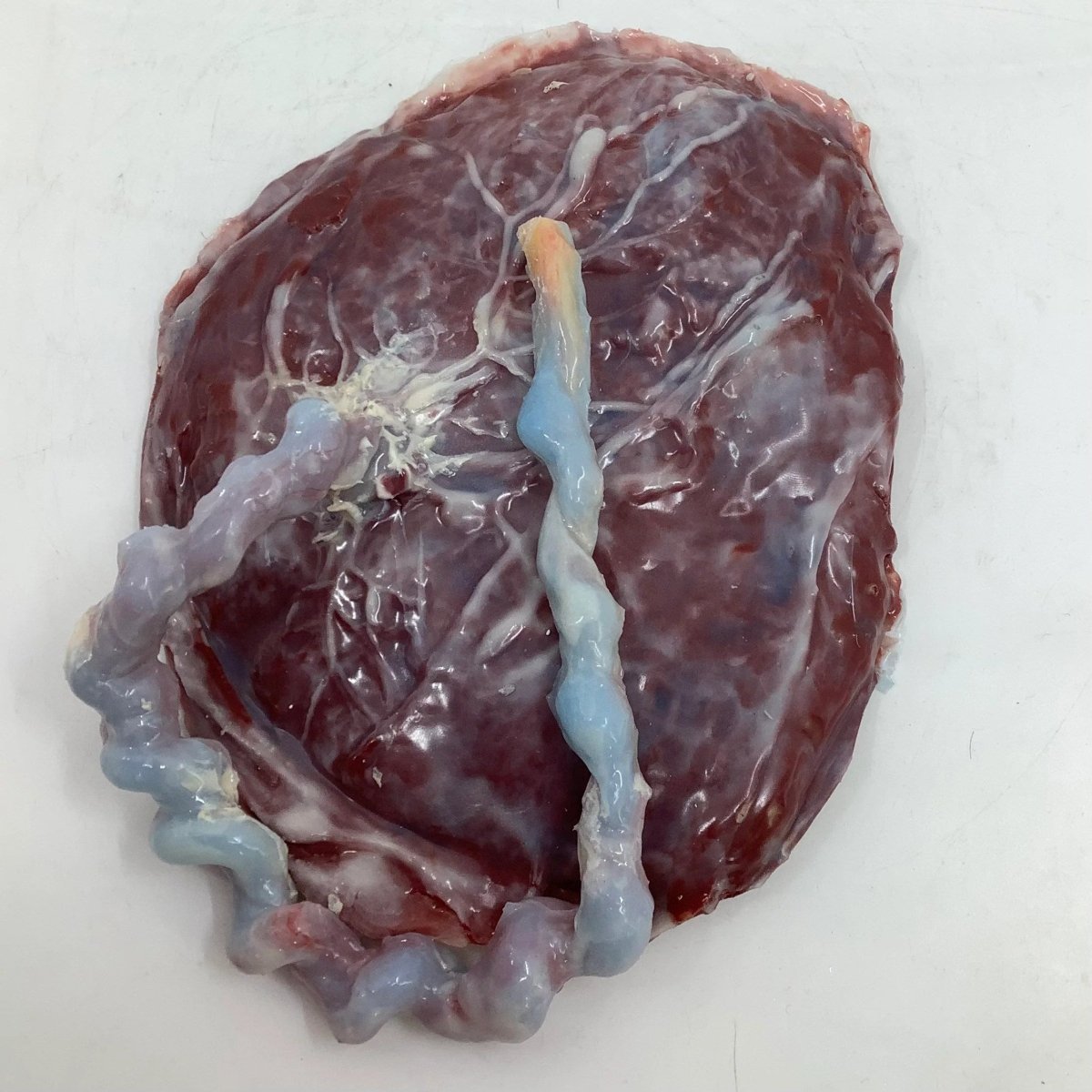 Full Term Placenta and Umbilical Cord for Skincare & Hair Growth - Natural Collagen Boost for Anti-Aging & Wound Healing | DIY Beauty, Organic Face Masks, Postpartum Recovery