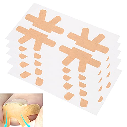 20pcs Ingrown Toenail Correction Stickers - Pain Relief & Treatment Tape for Ingrown Toenails - Nail Care Corrector Bandage Patches - Perfect for Pedicures, Post-Surgery Care & Daily Foot Comfort