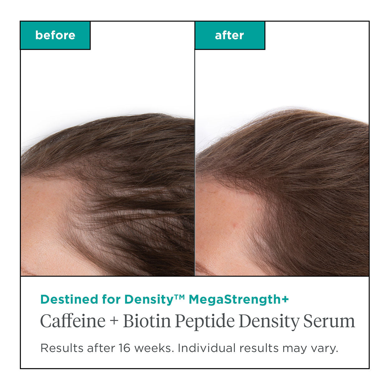 Destined for Density MegaStrength+ Caffeine & Biotin Peptide Hair Growth Serum for Thicker, Fuller Hair - Perfect for Thinning Hair & Scalp Care