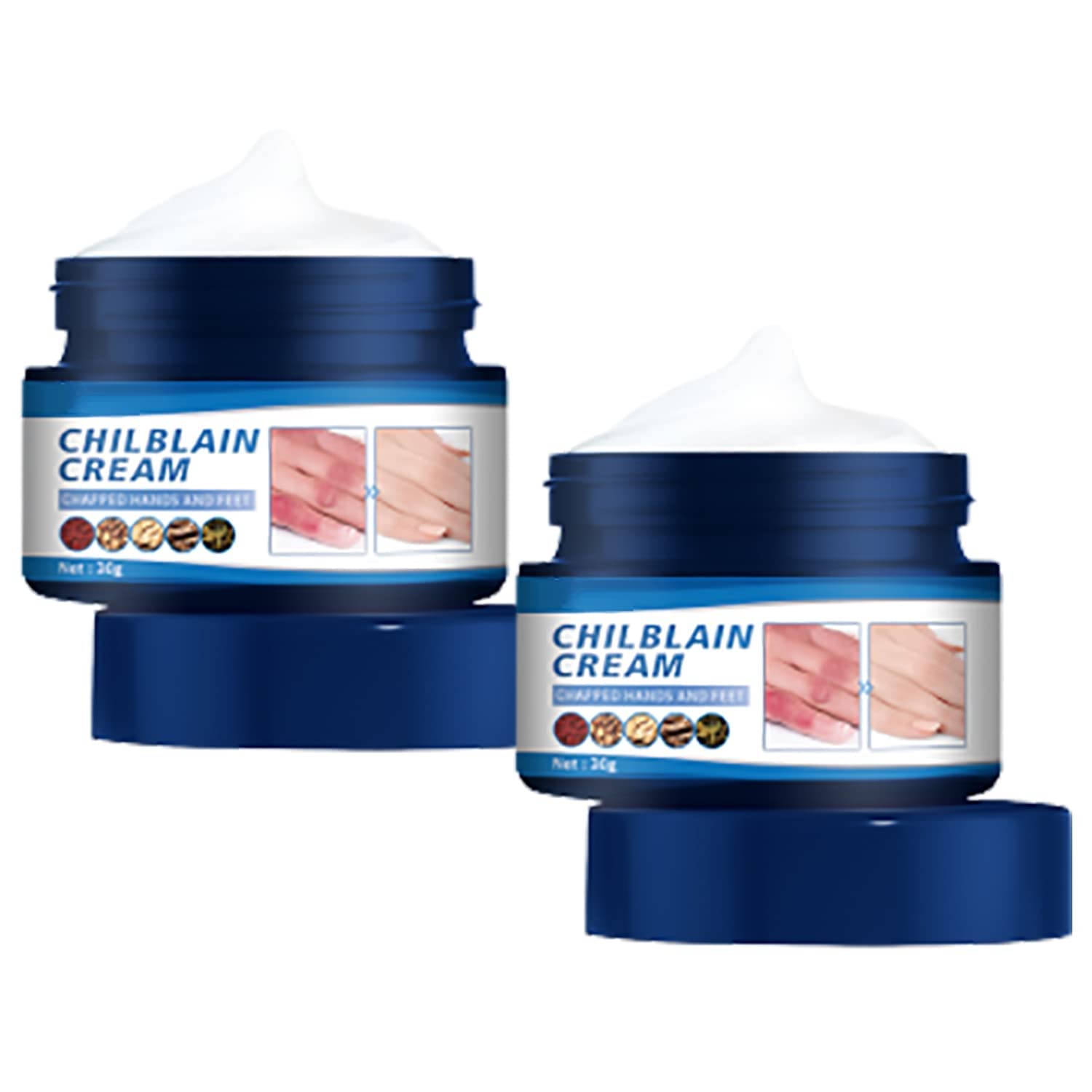 30ml Anti-Crack Frostbite Cream - Deep Moisturizing & Nourishing Foot & Hand Balm for Dry, Cracked Heels & Chilblains (2 Pack) - Perfect for Winter Skin Care & Extreme Cold Weather Protection