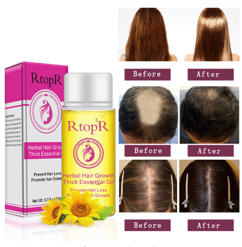 Fast Powerful Hair Growth Essential Oil Treatment - 20ml Liquid for Preventing Hair Loss & Stimulating Growth | Natural Hair Care Solution for Thinning Hair & Scalp Health | Perfect for Daily Use & Hair Regrowth Routine
