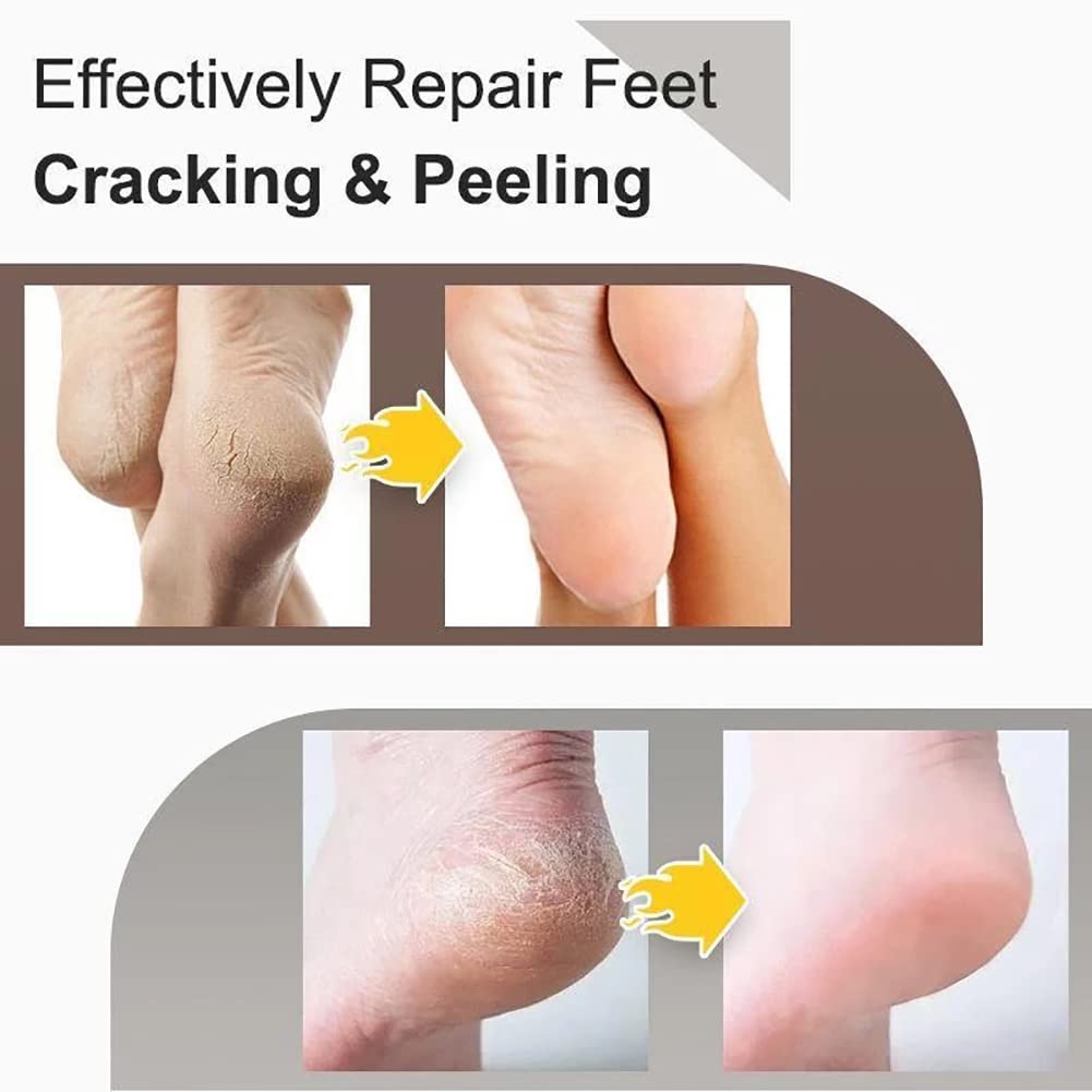 LLYAND Cracked Skin Repair Cream - Intensive Healing for Dry, Cracked Hands & Feet - Anti-Dryness & Crack Prevention - 15g Heel Balm - Perfect for Winter Skin Care & Extreme Dryness Relief