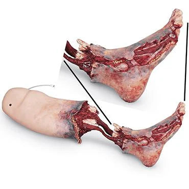 SmartStat Xtreme Trauma Bleeding Control Leg Bandage - First Aid Emergency Tourniquet for Outdoor, Hiking & Tactical Use
