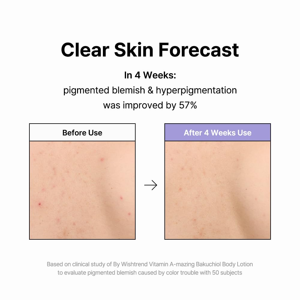 BY WISHTREND Bakuchiol Body Lotion 150g - Korean Moisturizer for Bumpy Skin & Wrinkles - Perfect for Dry Skin Care Routine