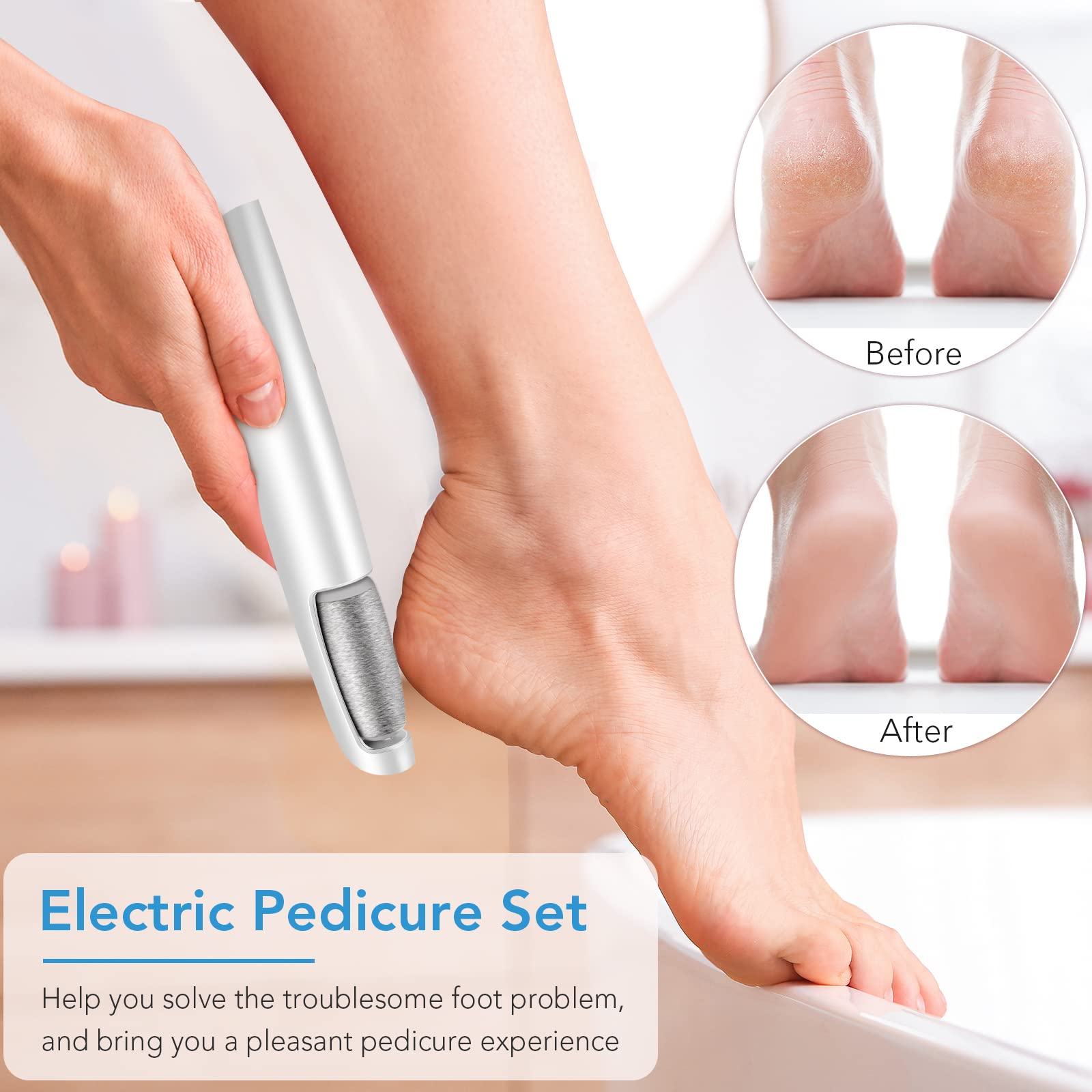 Electric Callus Remover for Feet - Professional Pedicure Kit with Foot Scrubber for Dry, Dead, Cracked & Hard Skin - Home Spa Care for Men & Women (Cold White) - Perfect for At-Home Pedicures & Foot Care Routines