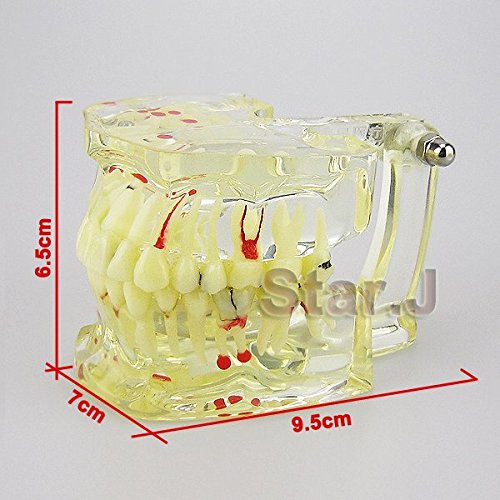 Dental Study Model - Transparent Adult Teeth Pathological Model for Dentists & Students | Perfect for Dental Education, Training & Practice