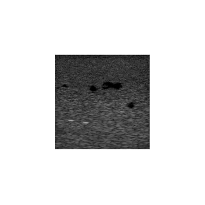 Deep Vein Thrombosis (DVT) Training Phantom Model - Medical Simulation Device for Ultrasound Practice & Vascular Diagnosis Training
