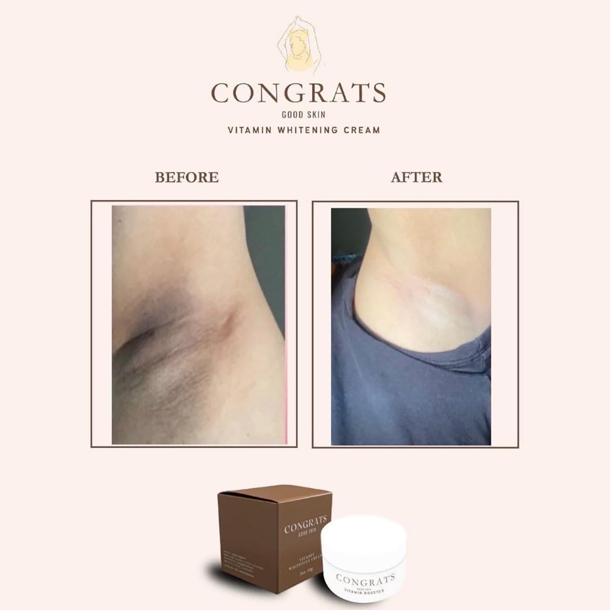 Large 50g/Box Congratulations Underarm Brightening Cream with Skin Vitamins (Pack of 3) by ThaiGiftShop | Free Tomato Facial Mask Included | For Dark Underarms & Smooth Skin Care