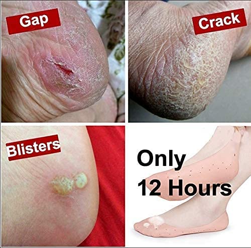 Anti Crack Full Length Silicone Foot Protector Socks - Moisturizing Heel & Foot Care for Cracked Feet, Heel Pain Relief - Perfect for Overnight Treatment, Dry Skin Repair & Diabetic Foot Comfort