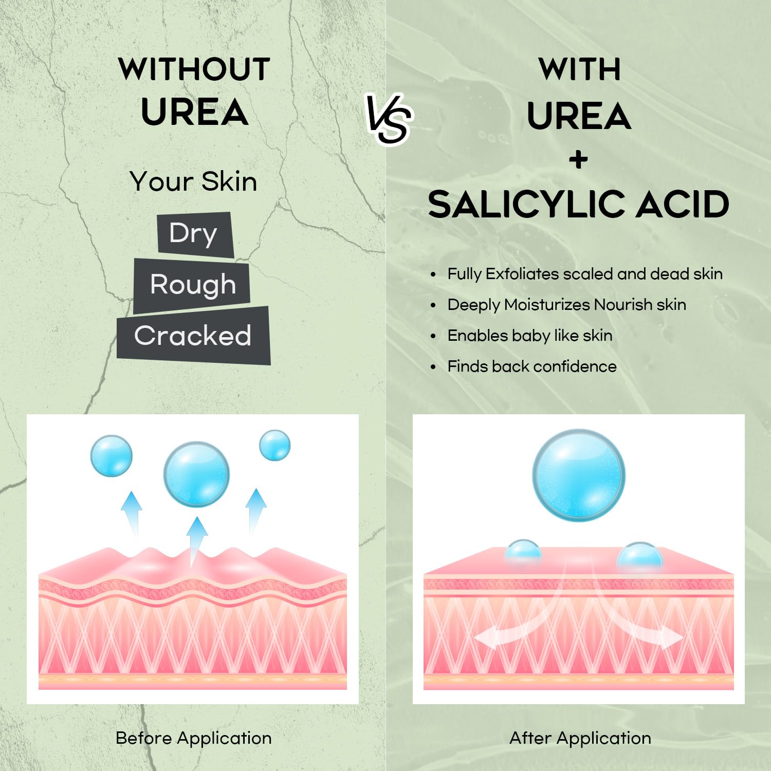 42% Urea Cream with Salicylic Acid - 4oz Callus Remover for Feet, Knees & Elbows | Intensive Moisturizer & Skin Softener | Dead Skin Exfoliator | Perfect for Dry, Cracked Heels & Rough Skin Care at Home